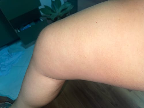 Close-up da coxa da cliente mostrando uma pele lisa, um resultado do uso do Kit Cuidado Potente.