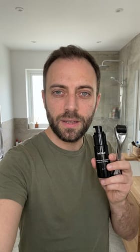 Customer photo review of Kit de crecimiento capilar