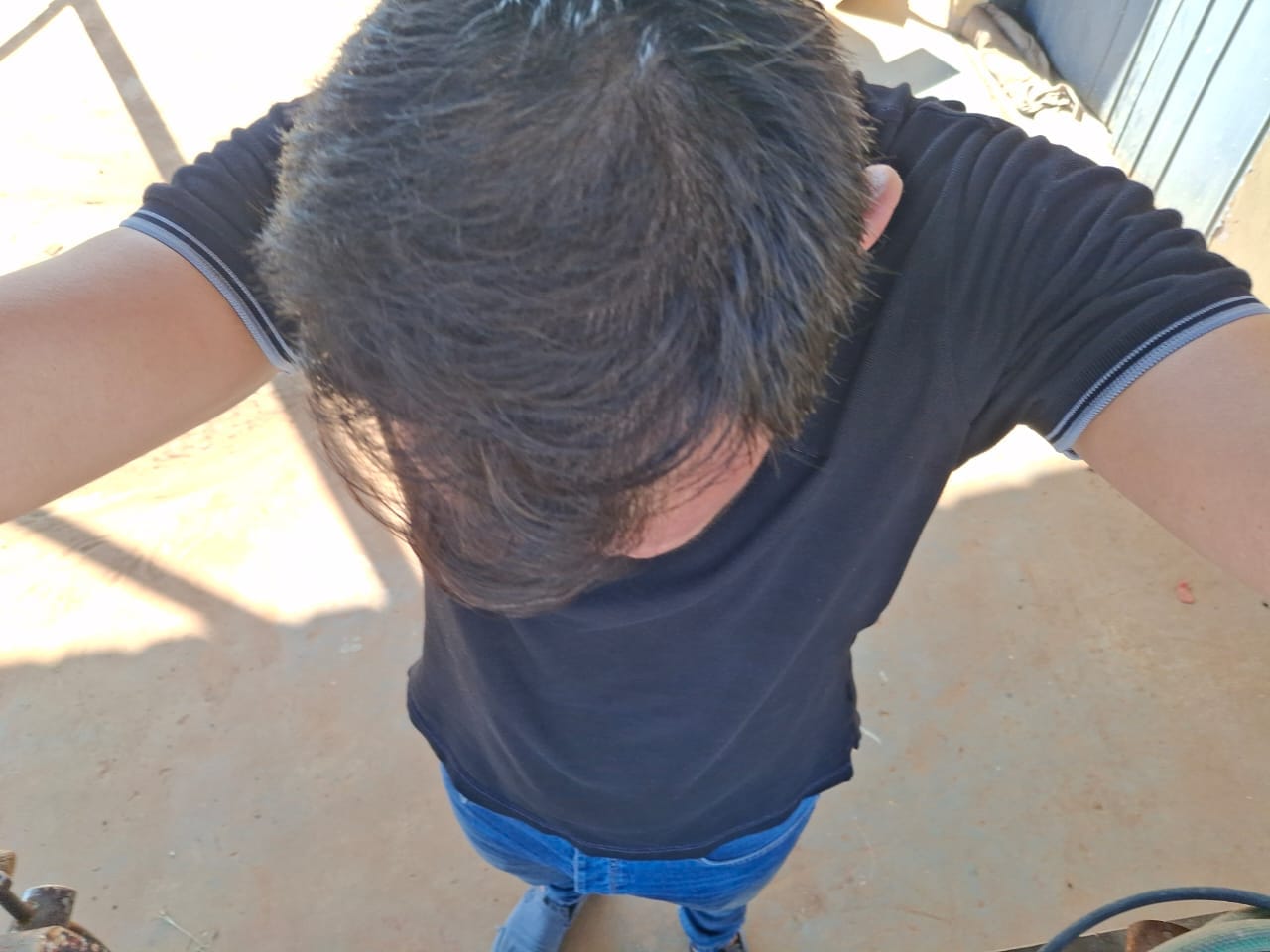 Customer photo review of Minoxidil DOUBLE ACTION FOAM, MEN ONLY 3x60ml Pack