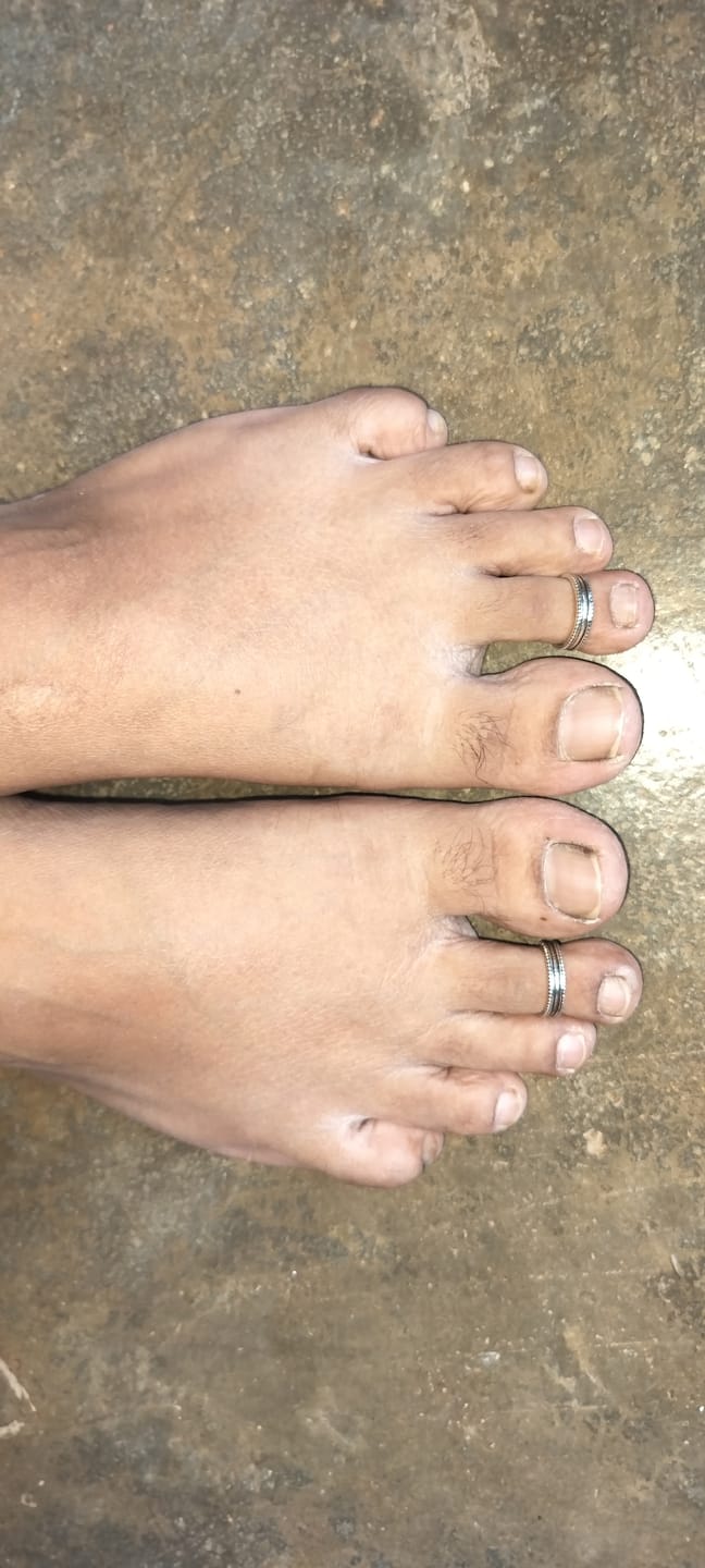 Customer photo review of Oxidised Silver Layered Bead Toe Ring