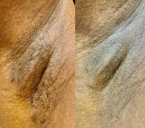 Customer photo review of Carekin™ Dual Trimmer
