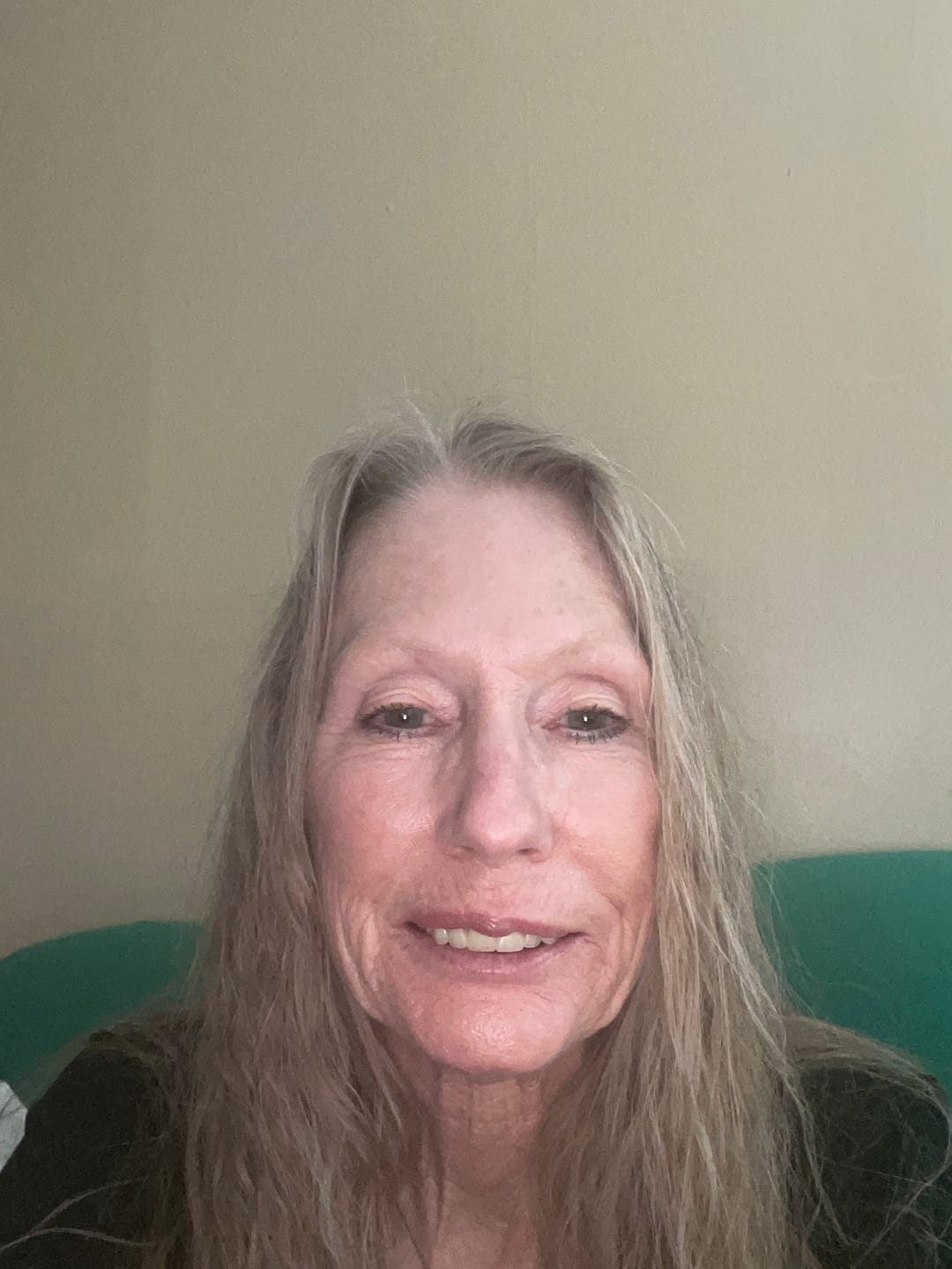 Customer photo review of 1 Month Supply - Micro Infusion Patches