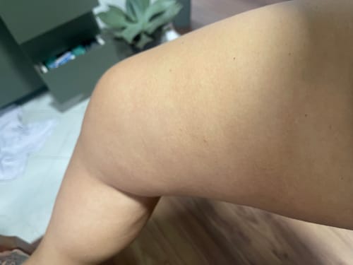 Close-up da coxa da cliente mostrando a pele com aparência mais lisa após o uso do Kit Cuidado Potente.