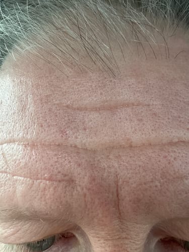 Customer photo review of Seb Natural Calming Serum