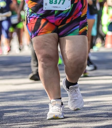 Cliente correndo, mostrando a pele da coxa em uma foto de "antes" para a avaliação do Kit Cuidado Potente.