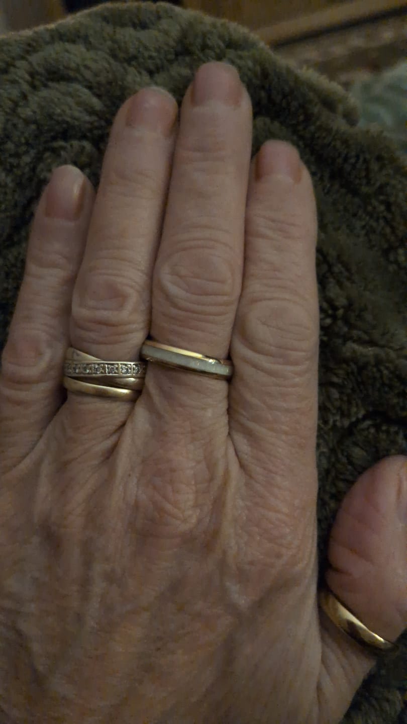 Customer photo review of The Golden White Opal 4mm Wonder Ring