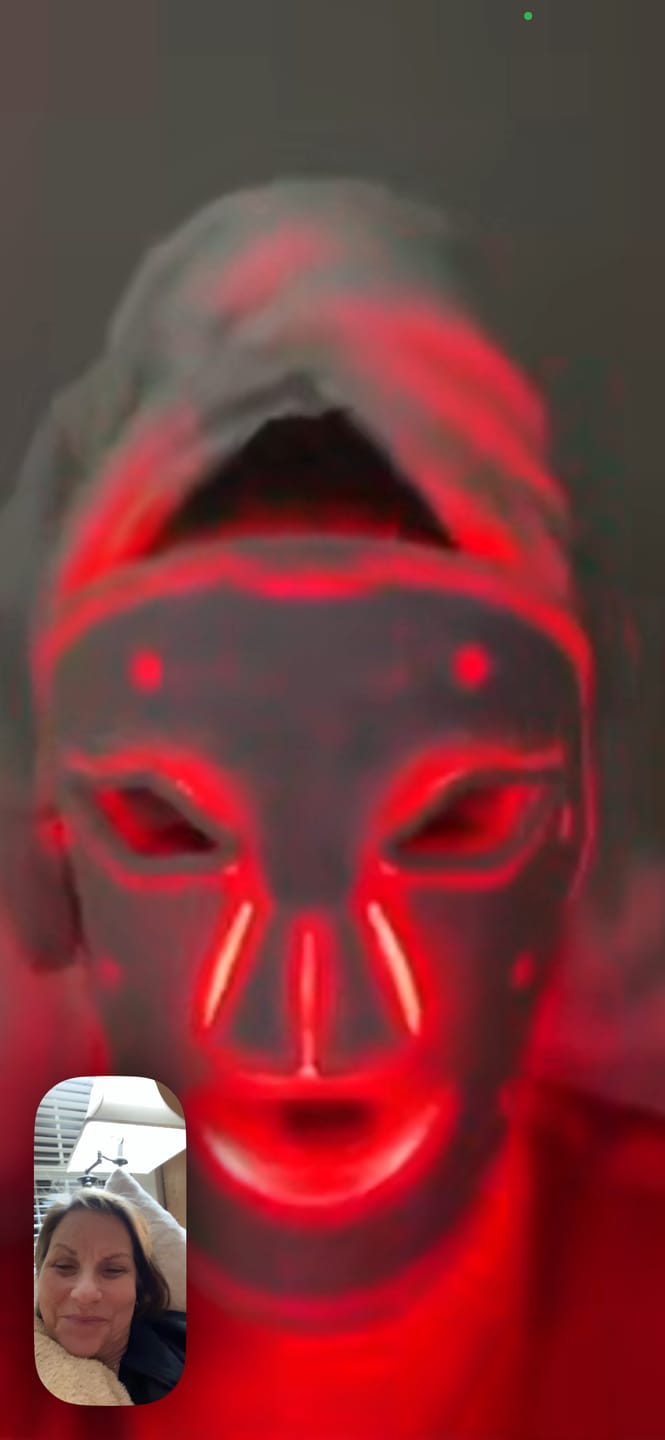 Customer photo review of INIA GLOW Wireless Red Light Therapy Mask