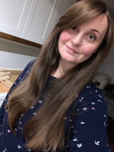 Customer photo review of Mermaid Hair: Postpartum Hair Loss Supplement