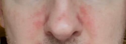 Customer photo review of Seb Natural Calming Serum