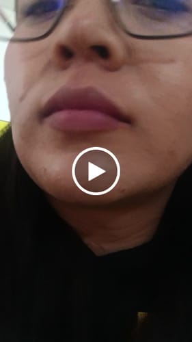 Customer video review of Kit Antiacné