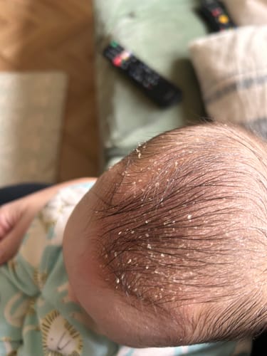 Customer photo review of Baby Scalp Oil