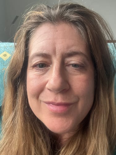 Customer photo review of Seb Natural Calming Serum