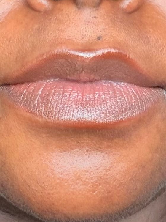 Customer photo review of Lips Lightening Cream For Men and Women (Results in 5 Days or Less)