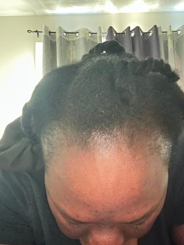 Customer photo review of Curlic Activator Pro + 2 FREE All-Natural Revitalizing Oil + E-Book