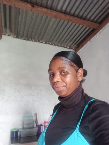 Customer photo review of Minoxidil 5% Solution, 1 Pack 60ml