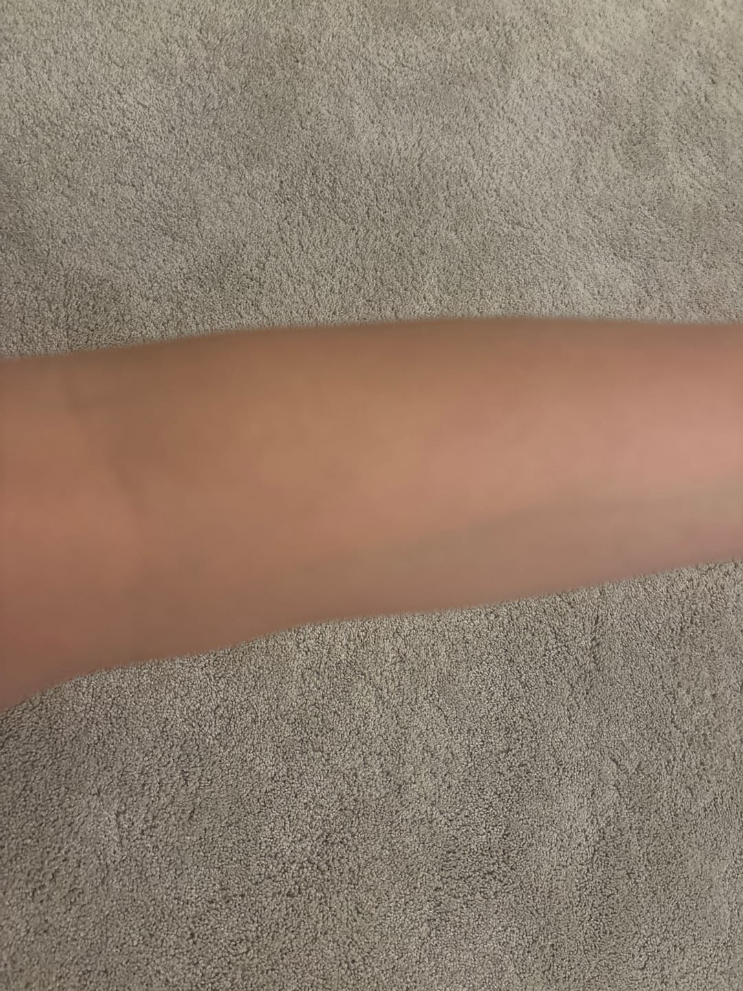 Customer photo review of Skin Saviour Balm