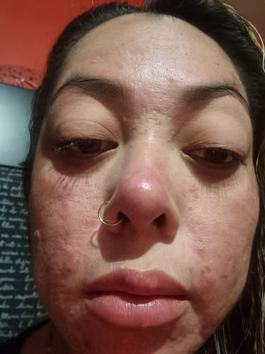 Customer photo review of Fórmulas Rx