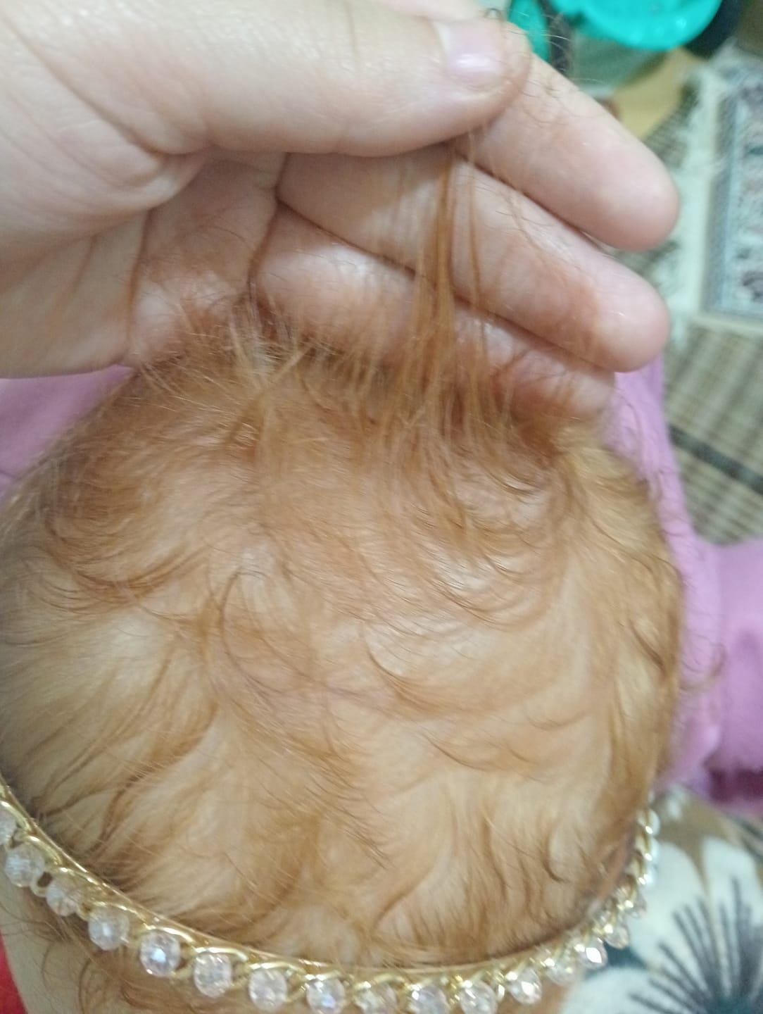 Customer photo review of Follicile Booster | Set of 2