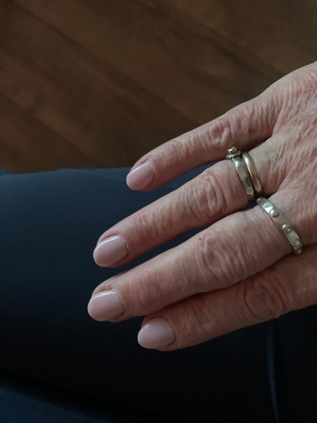 Customer photo review of Verwijderkom