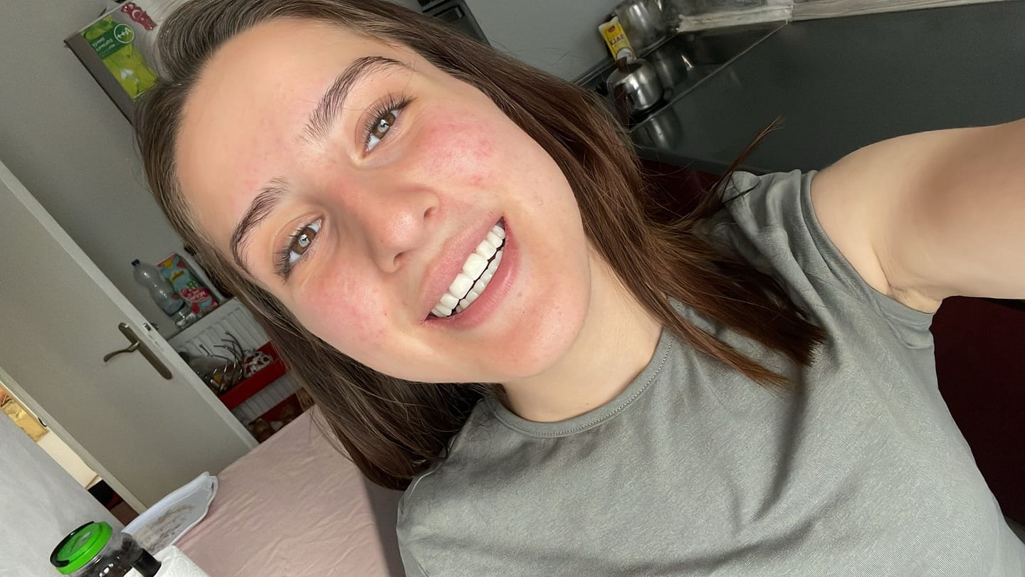 Customer photo review of Faccette-Dentali 3.0