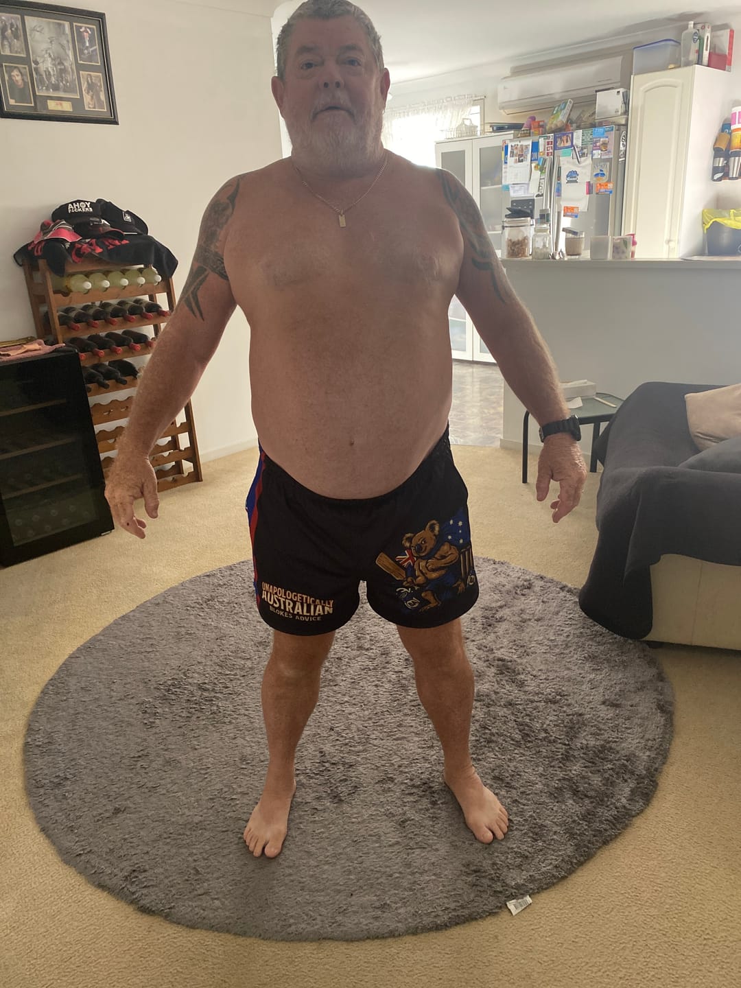 Customer photo review of Aussie As Footy Shorts