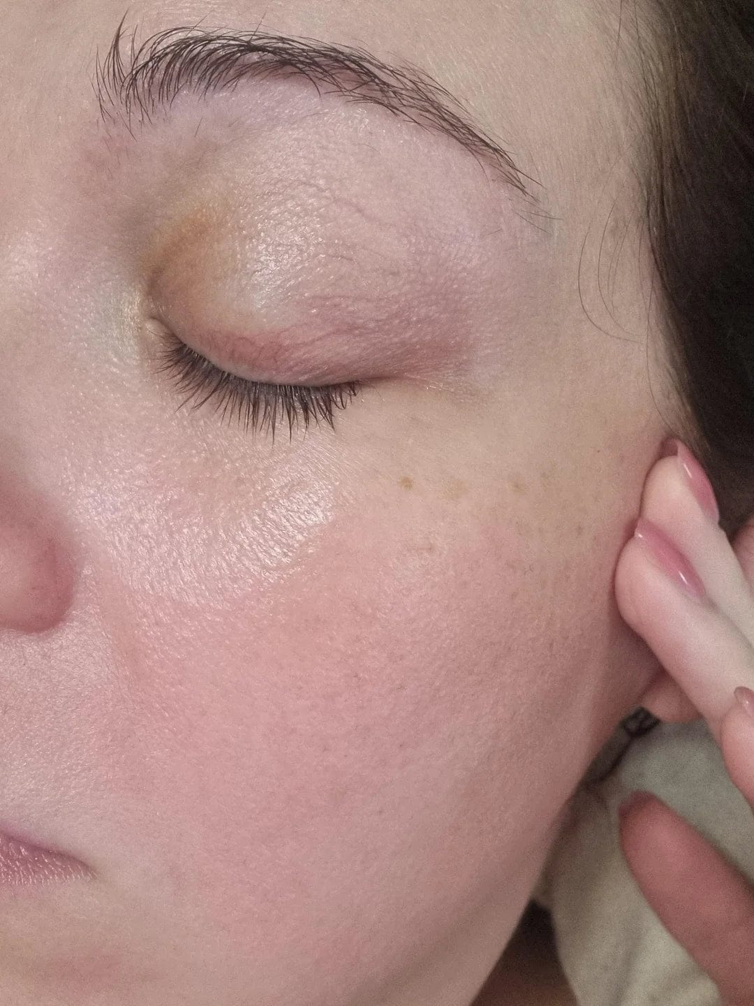 Customer photo review of LayaDerm - Retinal Shot