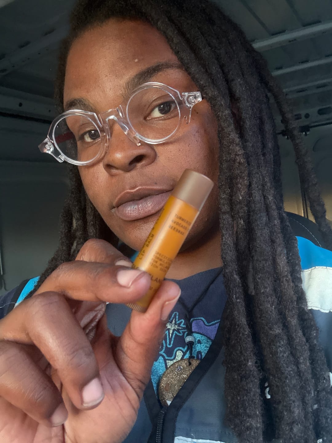 Customer photo review of Turmeric and Lemon Lip Balm (for Dark Lips)