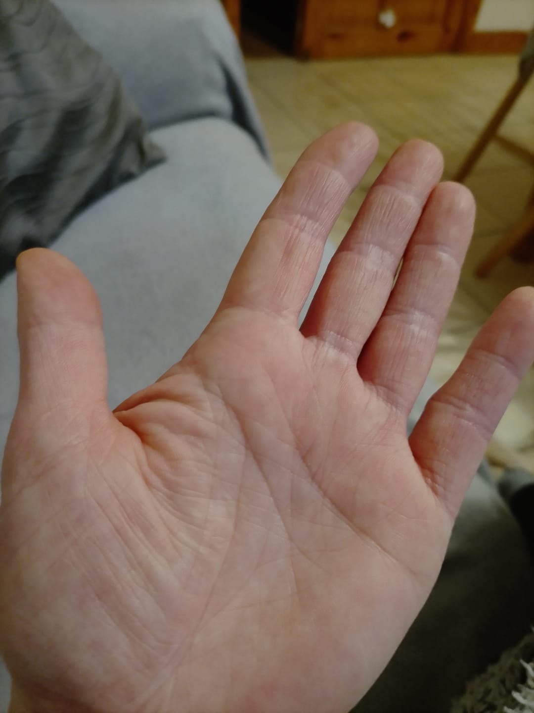 Customer photo review of Large Bioskin Duo Pack