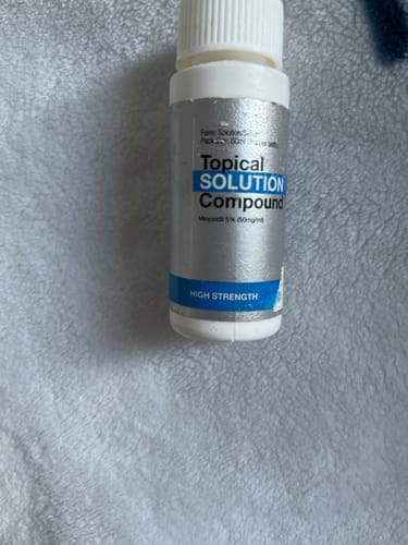 Customer photo review of Minoxidil 5% Solution, 1 Pack 60ml