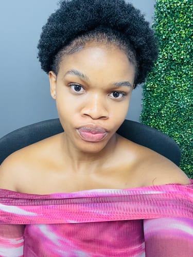 Customer photo review of Minoxidil High Strength (5%) SOLUTION, 3x60ml pack