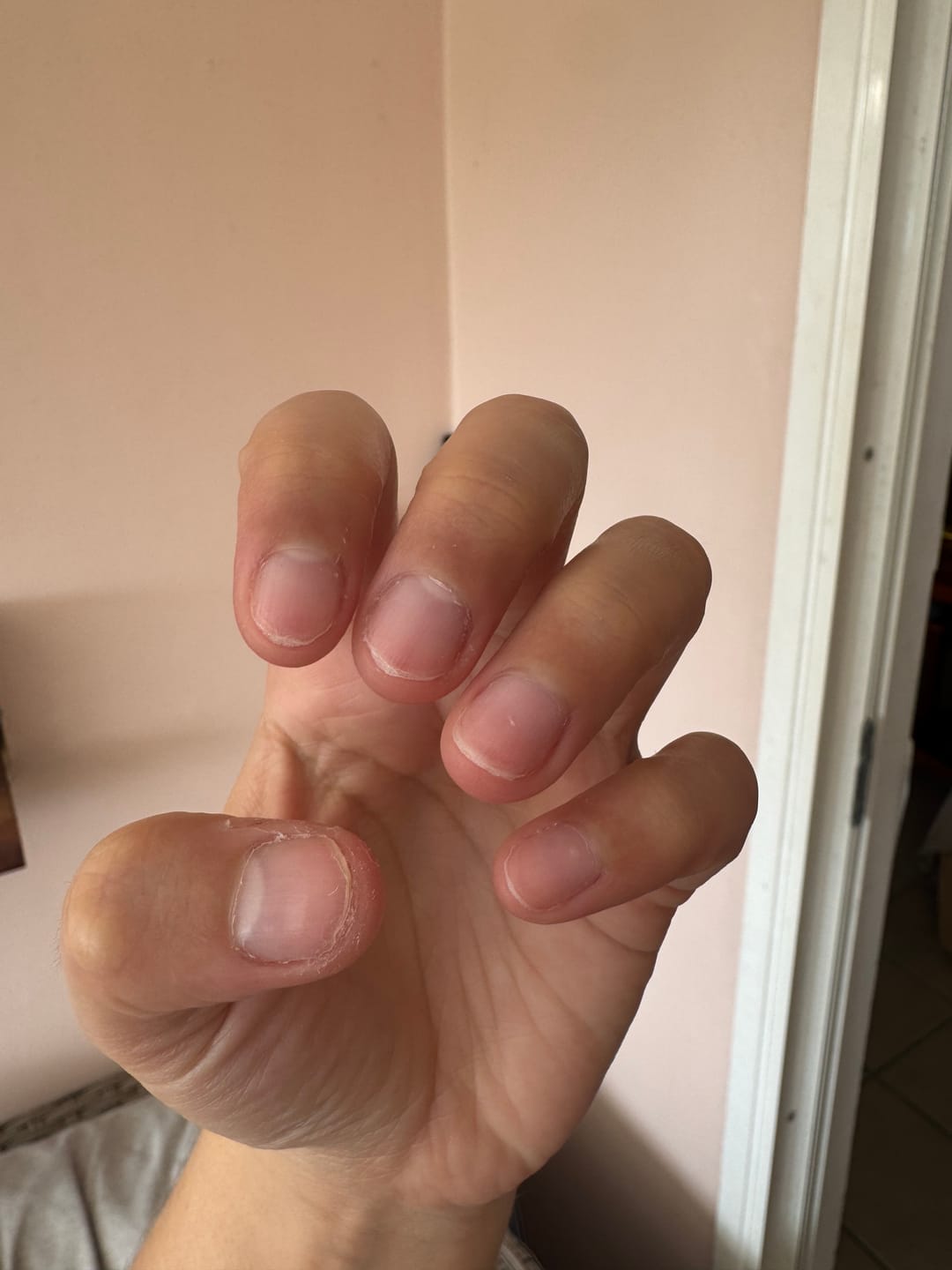 Customer photo review of Bague d'Anxiété Ajustable Alya