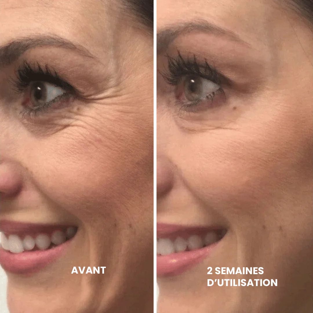 Customer photo review of LayaDerm - Retinal Shot