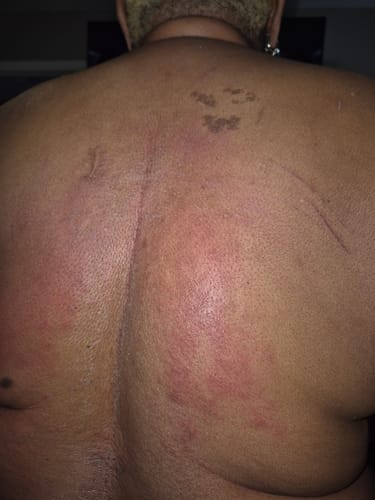 Customer photo review of [Nut-Free] Sweet Ginger Dry Oil for Sensitive Skin