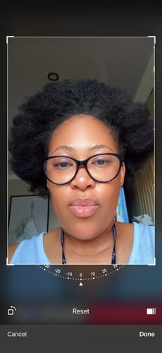 Customer photo review of Minoxidil High Strength (5%) FOAM, 3x60ml pack