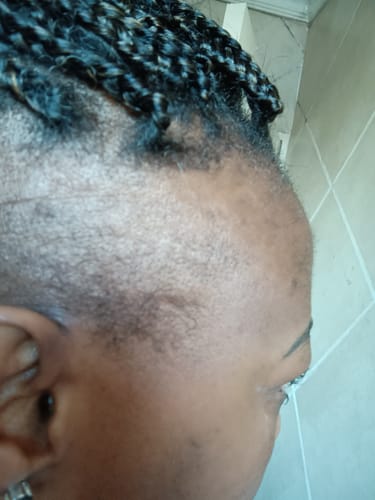 Customer photo review of Curlic Activator Pro + FREE All-Natural Revitalizing Oil + E-Book