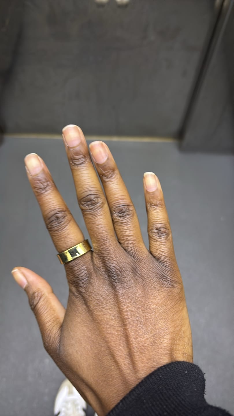 Customer photo review of Optim Ring