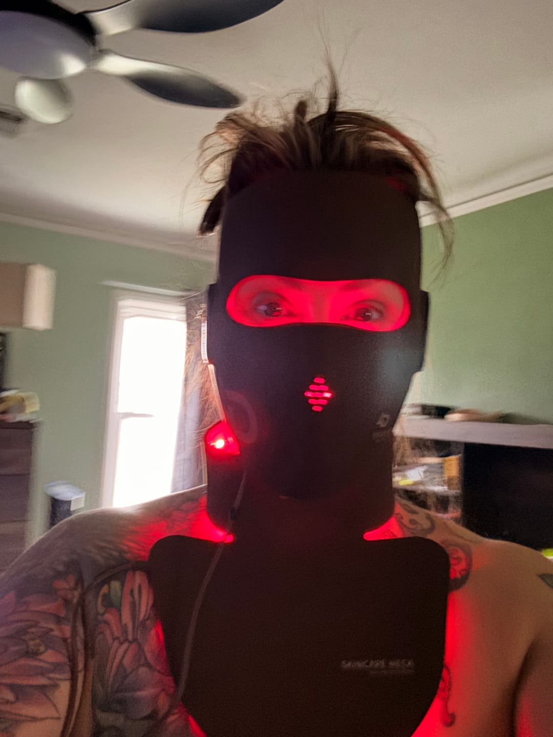 Customer photo review of JOVS 4D Laser Light Therapy Mask