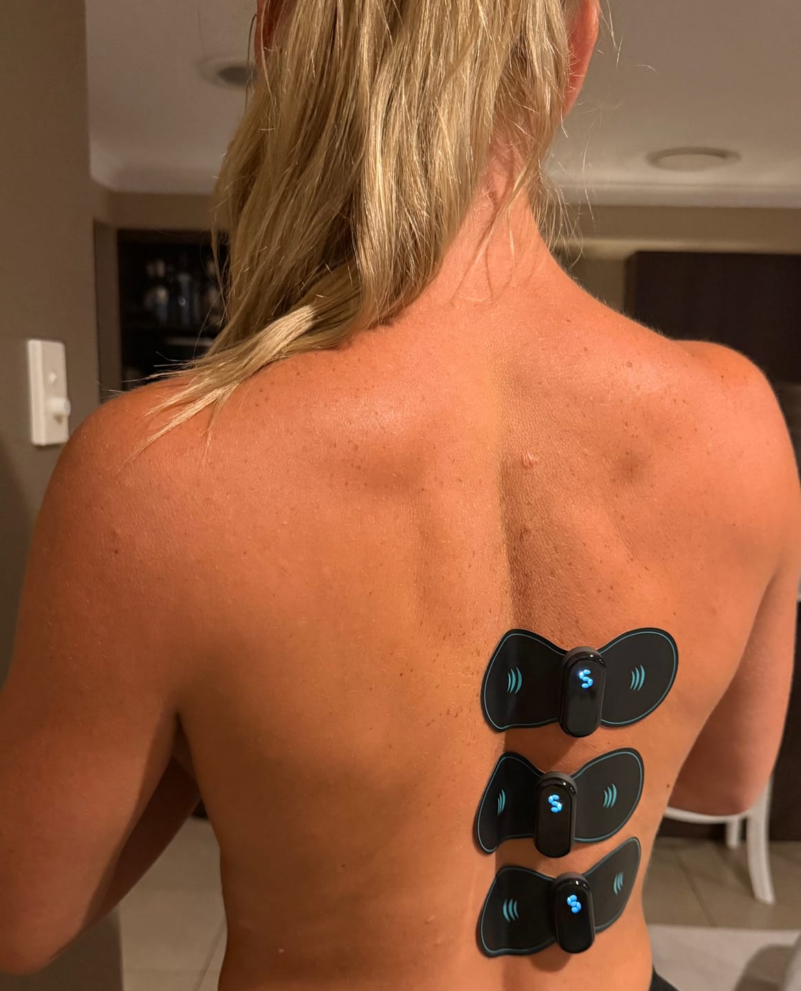Customer photo review of Vibit TENS - Electrical Nerve Stimulation Therapy