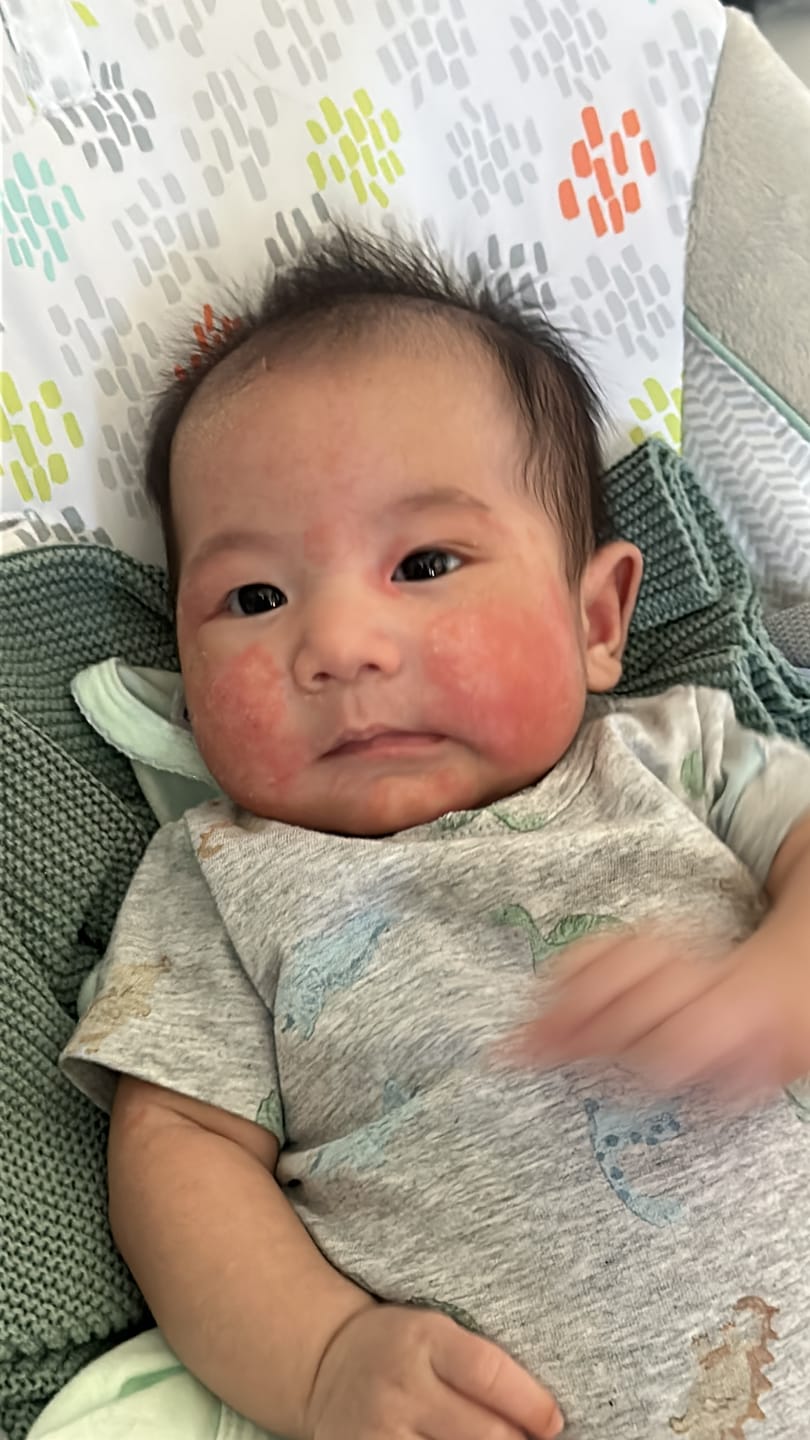 Customer photo review of Manuka Moisturising Baby Butter