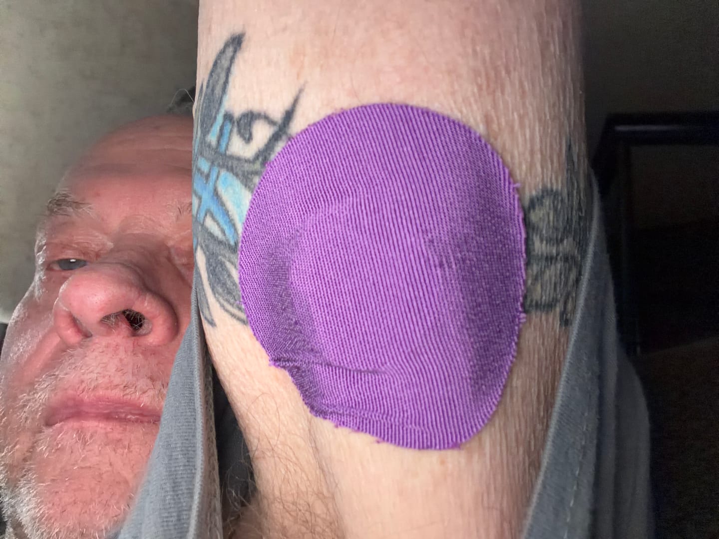Customer photo review of Skin Grip Original - Dexcom G7 & Stelo Adhesive Patches