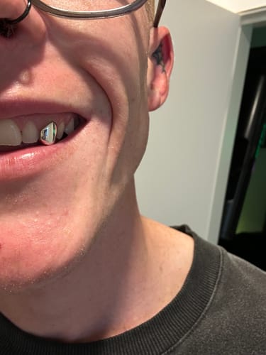 Customer photo review of ION (SILVER GRILLZ)