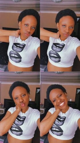 Customer photo review of Minoxidil High Strength (5%) SOLUTION, 3x60ml pack