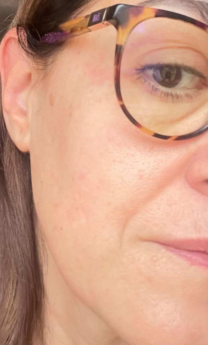 Customer photo review of Pack Sérum Ultra Rejuvenecedor & Limpiador Facial Cell Reset