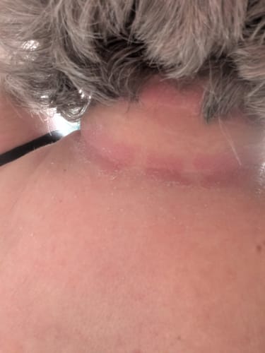 Customer photo review of Seb Natural Calming Serum