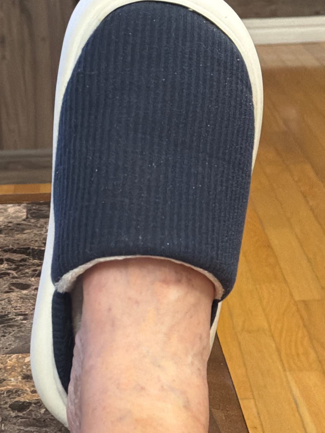 Customer photo review of Cloud Slides - Cozy Plush Fur-Lined Slippers