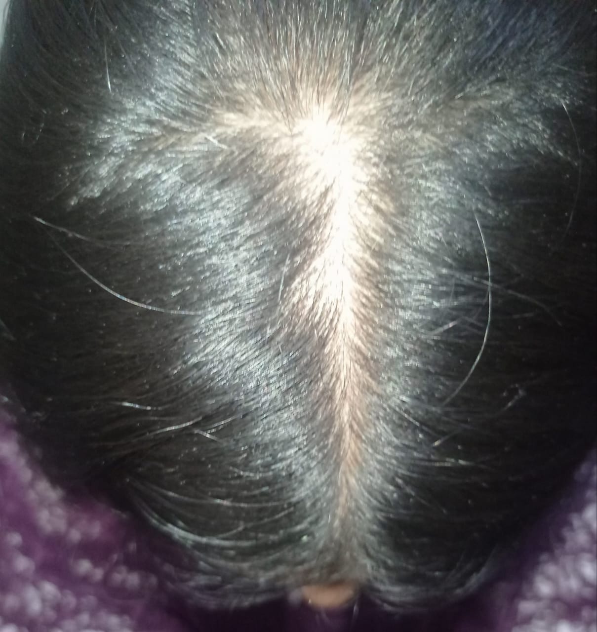 Customer photo review of Anagrow Rosemary Hair Oil
