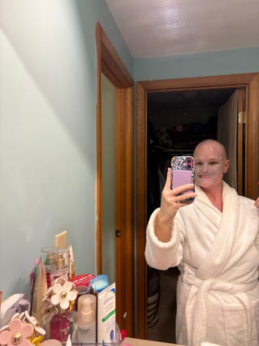 Customer photo review of Chemo Cream for Scalp