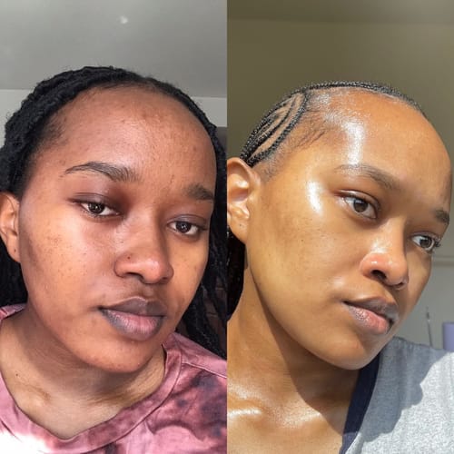 Customer photo review of FULL - SET INTENSE WHITENNING