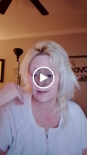 Customer video review of Imako® Cosmetic Teeth – Refill Kit