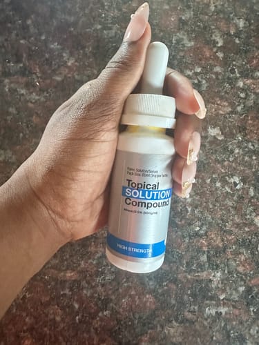 Customer photo review of Minoxidil 5% Solution, 1 Pack 60ml